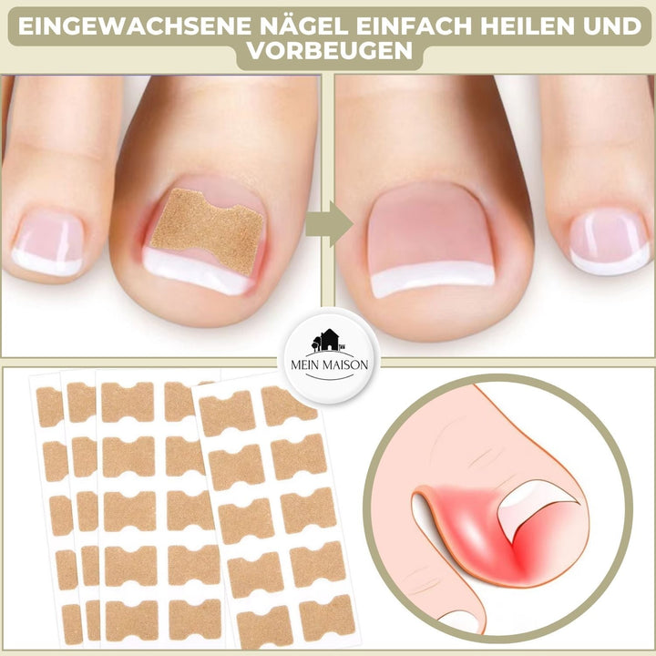 10+10 GRATUIT | FixaNail - Réparation instantanée des ongles