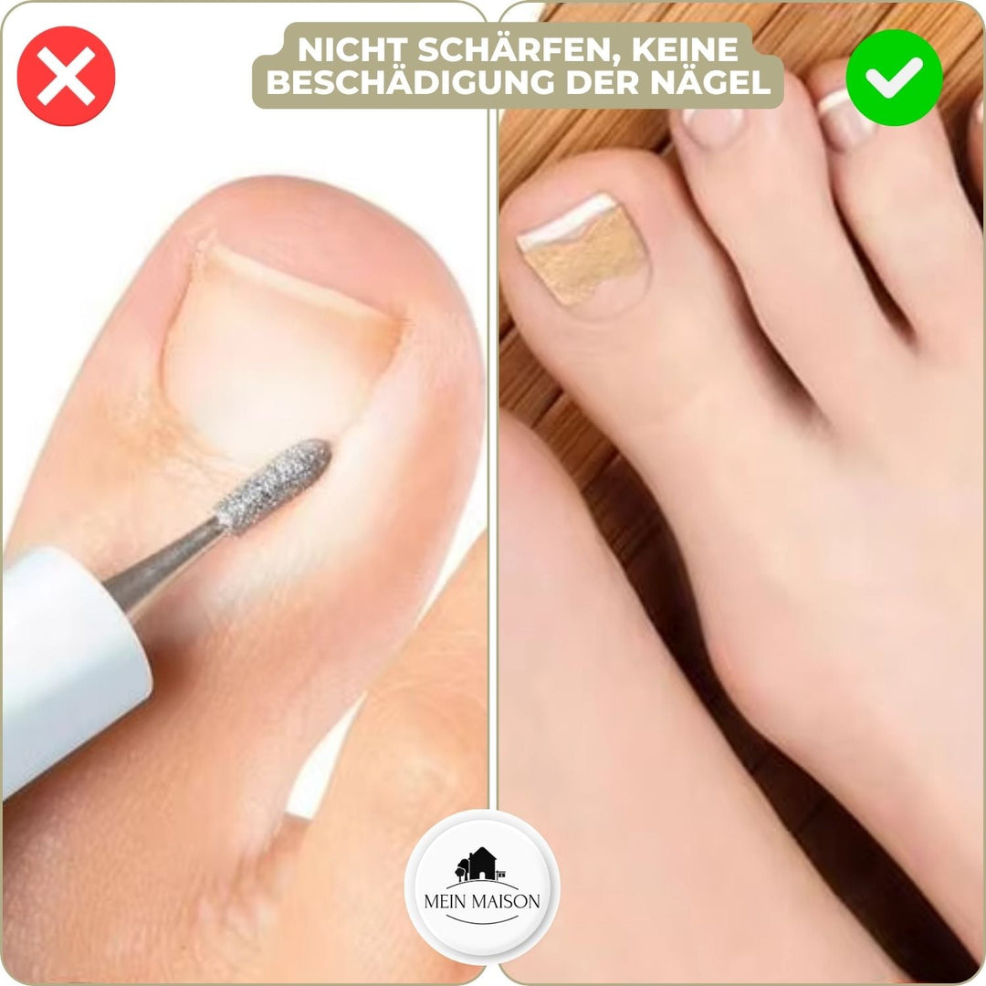 10+10 GRATUIT | FixaNail - Réparation instantanée des ongles