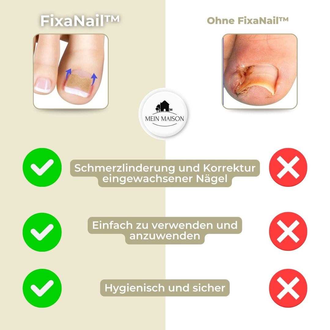 10+10 GRATUIT | FixaNail - Réparation instantanée des ongles