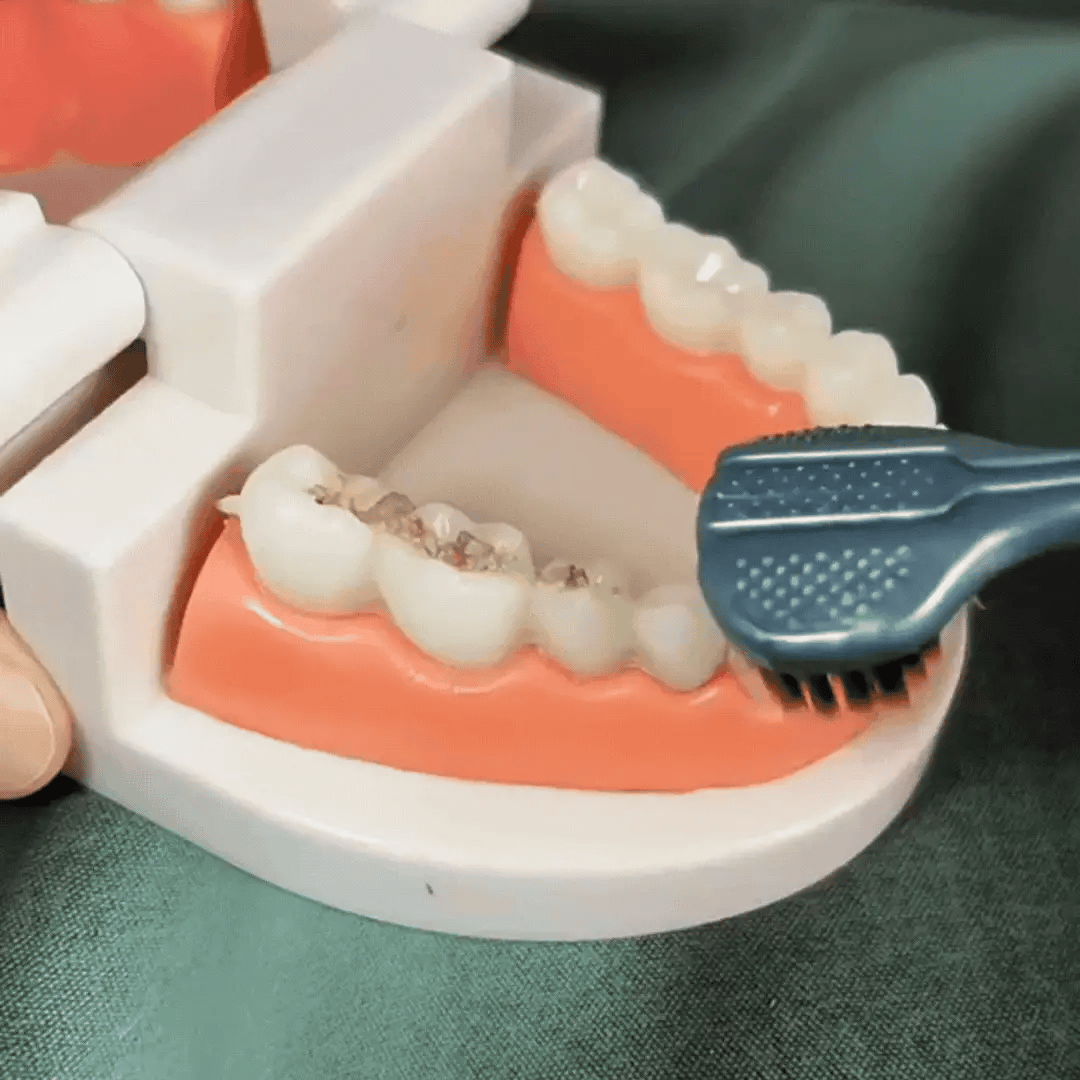 BrushHalo – La brosse à dents 360° !